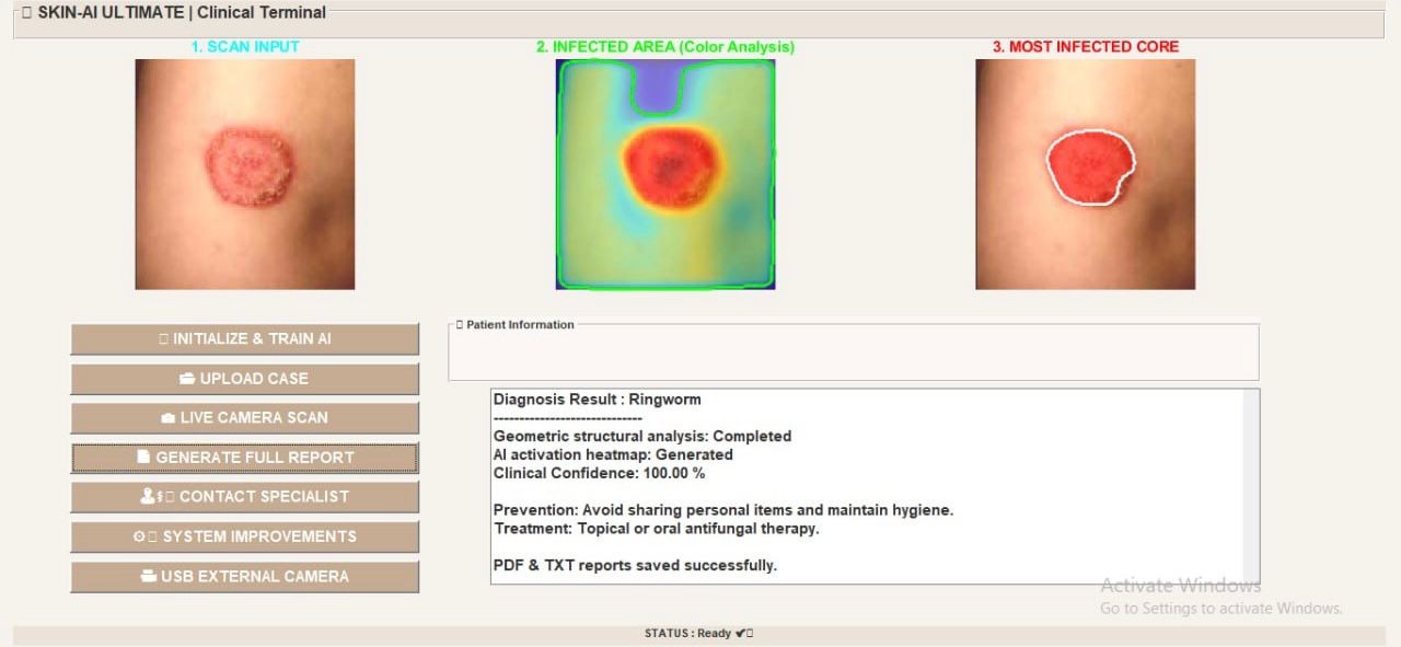صورة مشروع DermaScan AI: A Reliable Deep Learning System for Automated Skin Disease Diagnosis