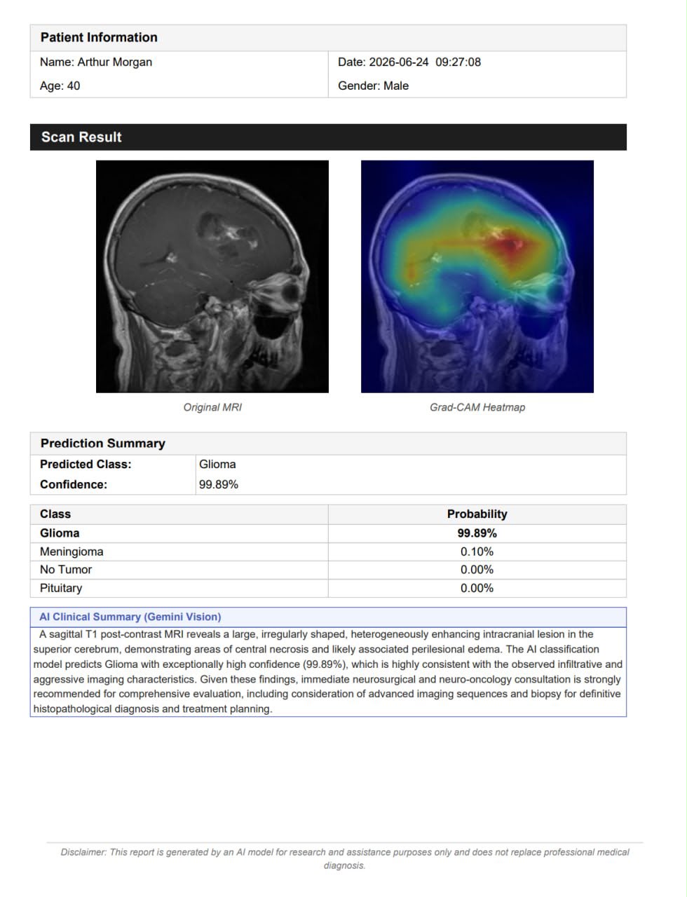 صورة مشروع The Project: An Explainable AI System for Brain Tumor Classification  and Automated Clinical Reporting