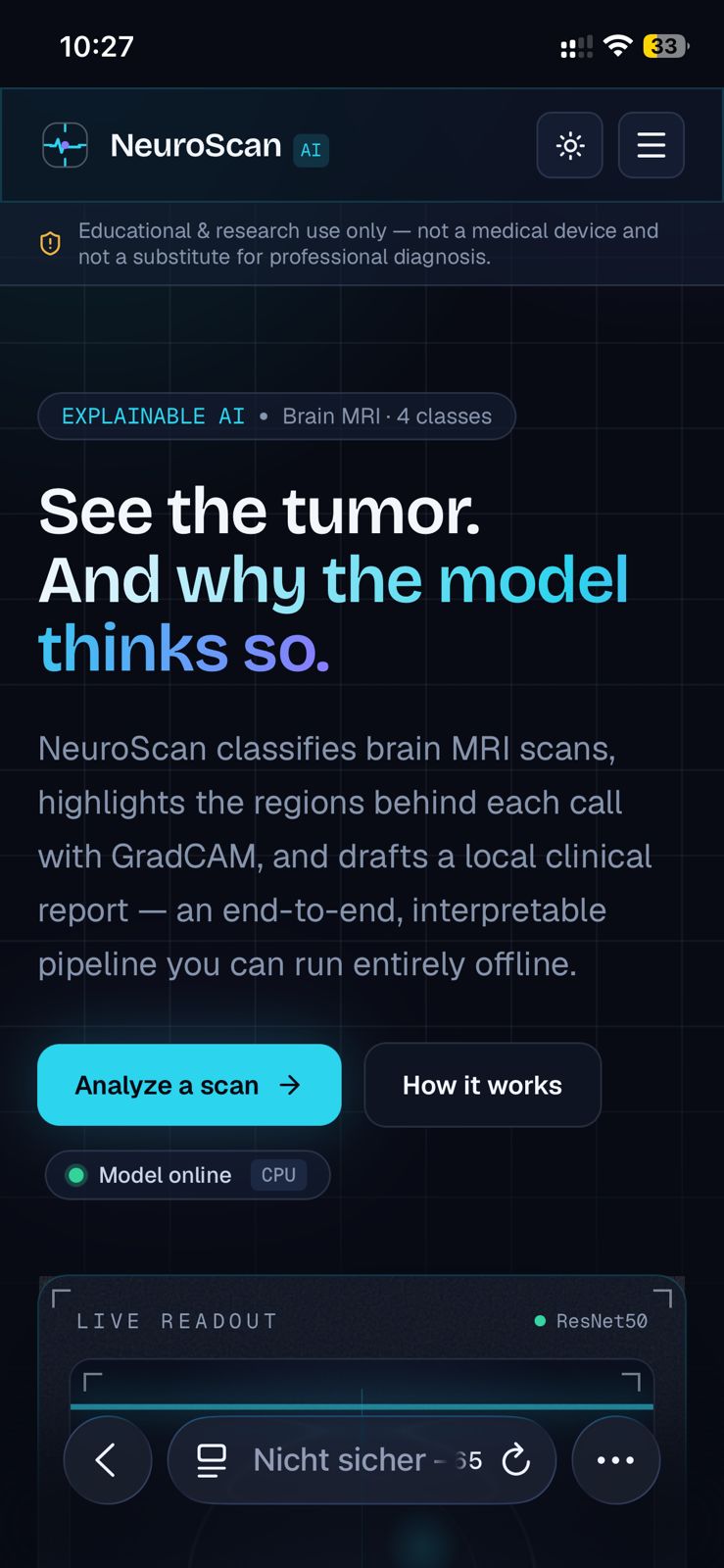 صورة مشروع Brain Tumor Detection and Classification Using Deep Learning