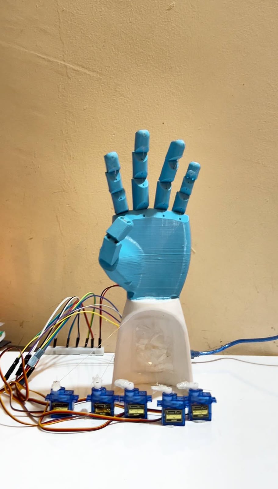 صورة مشروع Design and Implementation of a Low-Cost Vision-Controlled Smart Prosthetic Hand Using Real-Time Hand-Gesture Recognition